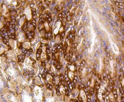 Immunohistochemistry-Paraffin: PUMA Antibody (SR42-09) [NBP2-67326]