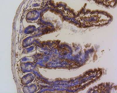 Immunohistochemistry-Paraffin: PUMA Antibody (SR42-09) [NBP2-67326]