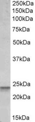 Western Blot: PUMA Antibody [NBP1-52093]