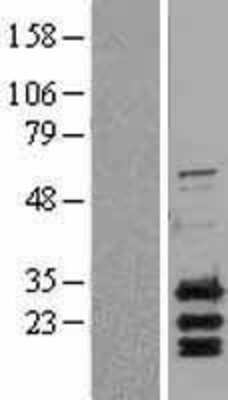 Western Blot: PUMA Overexpression Lysate [NBL1-07925]