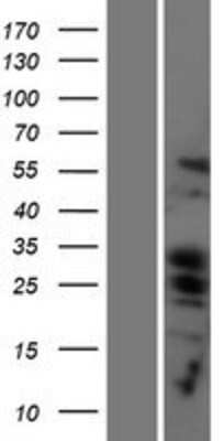 Western Blot: PUMA Overexpression Lysate [NBP2-11377]