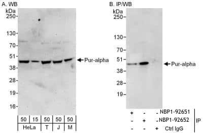 Western Blot: PURA Antibody [NBP1-92651]