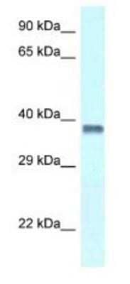 Western Blot: PURA Antibody [NBP1-82400]