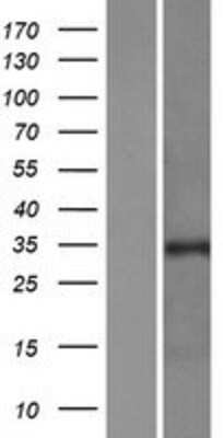 Western Blot: PURA Overexpression Lysate [NBP2-07695]