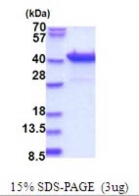 SDS-PAGE: Recombinant Human PURB His Protein [NBP2-51699]