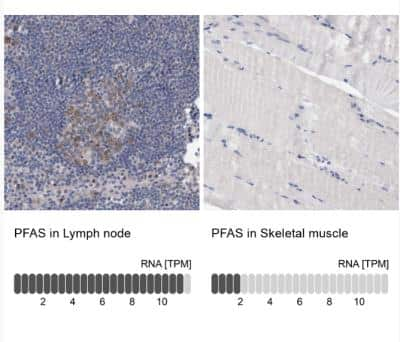 Immunohistochemistry-Paraffin: PURL Antibody [NBP1-84691]