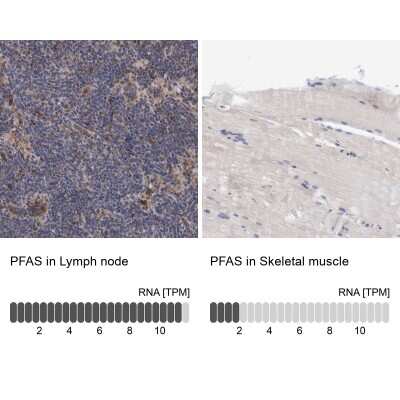 Immunohistochemistry-Paraffin: PURL Antibody [NBP1-84692]