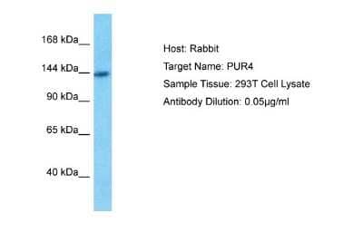 Western Blot: PURL Antibody [NBP1-70692]