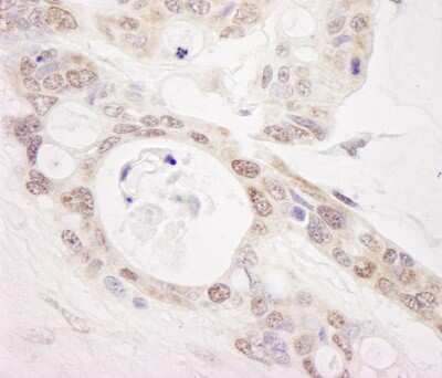 Immunohistochemistry: PUS1 Antibody [NB100-86983]