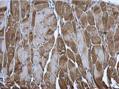 Immunohistochemistry-Paraffin: PUS1 Antibody [NBP1-32902]