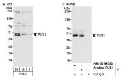 Western Blot: PUS1 Antibody [NB100-86983]