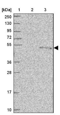 Western Blot: PUS1 Antibody [NBP2-13831]