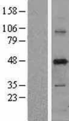 Western Blot: PUS1 Overexpression Lysate [NBL1-14996]