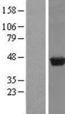 Western Blot: PUS1 Overexpression Lysate [NBP2-09088]