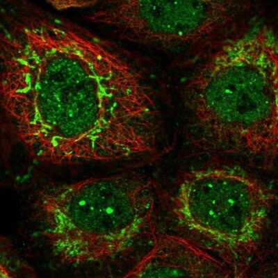 Immunocytochemistry/ Immunofluorescence: PUS10 Antibody [NBP2-48941]