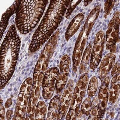 Immunohistochemistry-Paraffin: PUS10 Antibody [NBP2-30613]