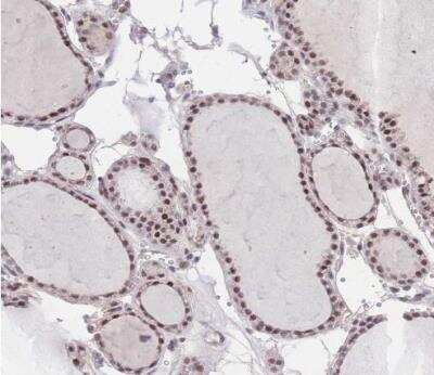 Immunohistochemistry-Paraffin: PUS10 Antibody [NBP2-48941]
