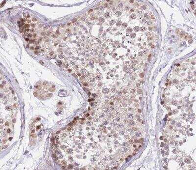 Immunohistochemistry-Paraffin: PUS10 Antibody [NBP2-48941]