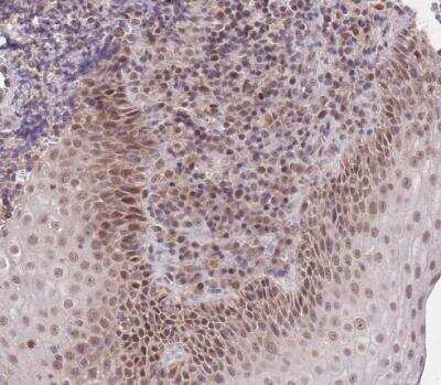 Immunohistochemistry-Paraffin: PUS10 Antibody [NBP2-48941]