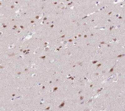 Immunohistochemistry-Paraffin: PUS10 Antibody [NBP2-48941]
