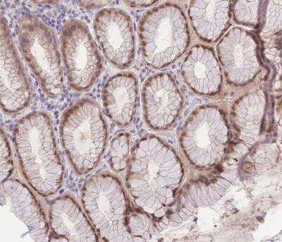Immunohistochemistry-Paraffin: PUS10 Antibody [NBP2-48941]