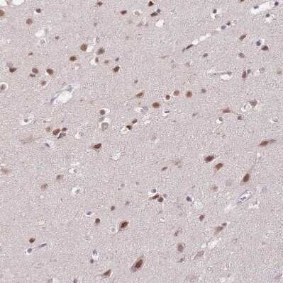 Immunohistochemistry-Paraffin: PUS10 Antibody [NBP2-48941]