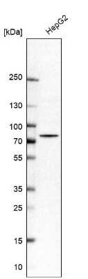 Western Blot: PUS10 Antibody [NBP2-48941]