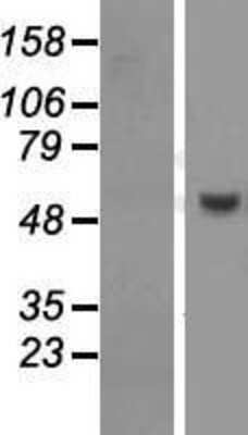 Western Blot: PUS10 Overexpression Lysate [NBL1-14998]