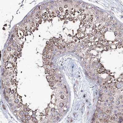 Immunohistochemistry-Paraffin: PUS3 Antibody [NBP1-83885]