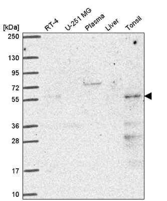 Western Blot: PUS3 Antibody [NBP2-55852]