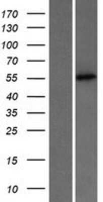 Western Blot: PUS3 Overexpression Lysate [NBP2-06135]