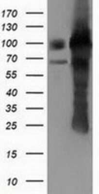 Western Blot: PUS7 Antibody (OTI5F12) [NBP2-03112]