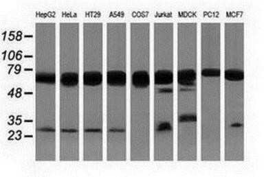 Western Blot: PUS7 Antibody (OTI5F12)Azide and BSA Free [NBP2-73733]