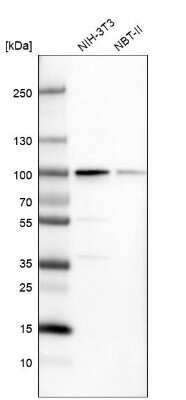 Western Blot: PUS7 Antibody [NBP1-83652]