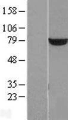 Western Blot: PUS7 Overexpression Lysate [NBL1-15000]