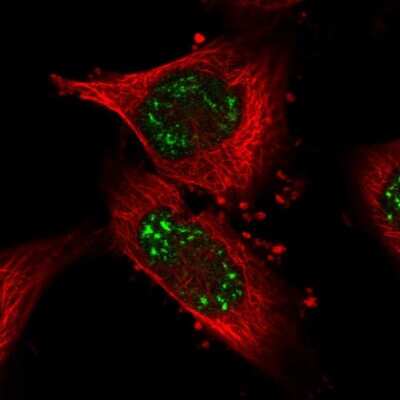 Immunocytochemistry/ Immunofluorescence: PUS7L Antibody [NBP2-31630]