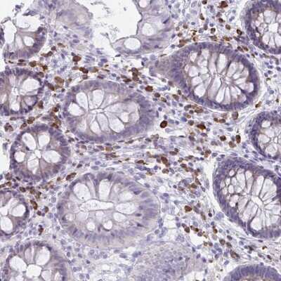 Immunohistochemistry-Paraffin: PUS7L Antibody [NBP2-31729]