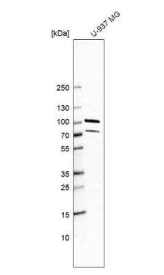 Western Blot: PUS7L Antibody [NBP2-31630]