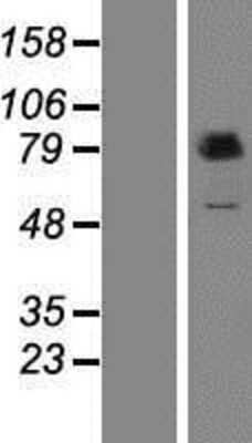 Western Blot: PUS7L Overexpression Lysate [NBP2-06140]