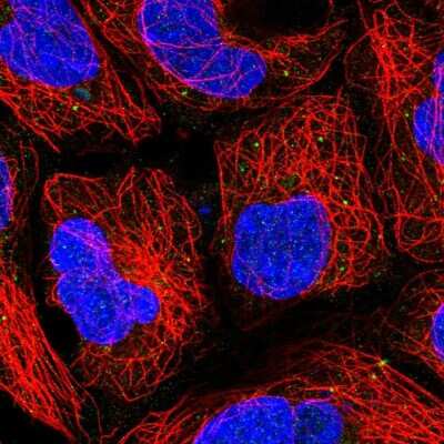 Immunocytochemistry/ Immunofluorescence: PUSL1 Antibody [NBP2-58604]