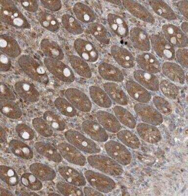 Immunohistochemistry-Paraffin: PUSL1 Antibody [NBP1-81876]