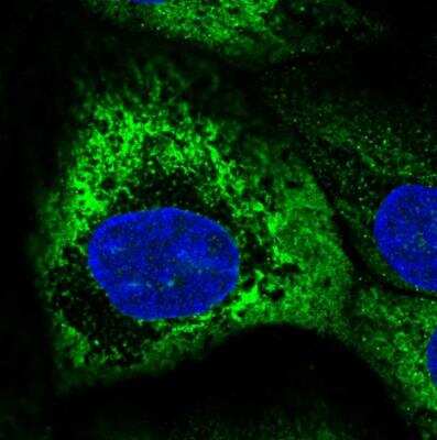 Immunocytochemistry/ Immunofluorescence: PVRIG Antibody [NBP2-13832]