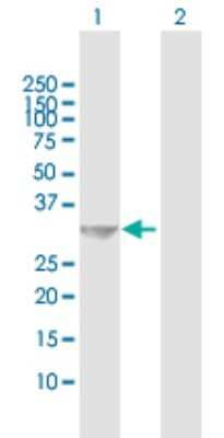 Western Blot: PVRIG Antibody [H00079037-B02P]