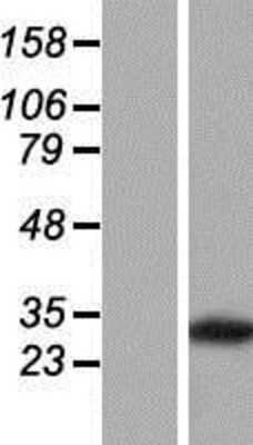 Western Blot: PVRIG Overexpression Lysate [NBP2-06358]