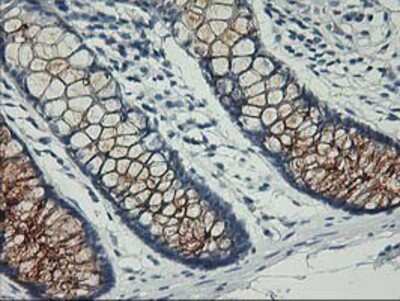 Immunohistochemistry-Paraffin: Nectin-1/PVRL1 Antibody (OTI6F8) [NBP2-01198]