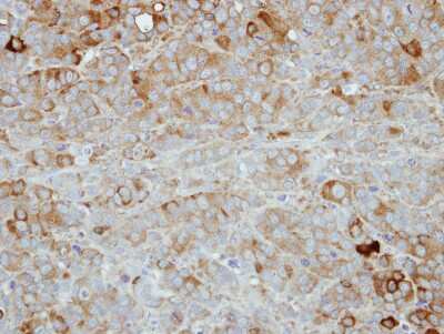 Immunohistochemistry-Paraffin: Nectin-4/PVRL4 Antibody [NBP2-20014]