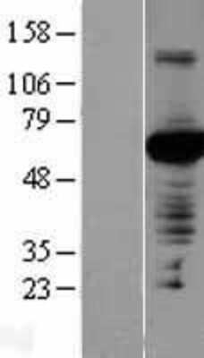 Western Blot: Nectin-4/PVRL4 Overexpression Lysate [NBL1-15008]