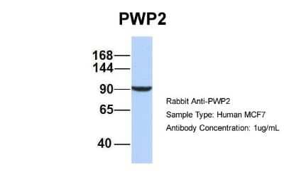 Western Blot: PWP2H Antibody [NBP1-52844]