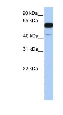 Western Blot: PWWP2A Antibody [NBP1-70642]