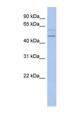 Western Blot: PWWP2B Antibody [NBP1-55176]